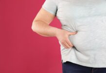 Obesity Doesn’t Just Affect Your Heart. New Research Says It May Cause Dementia Too. Obesity Doesn't Just Affect Your Heart