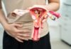 Ovulation Pain (Mittelschmerz): Causes, Symptoms, and When to Worry Ovulation Pain (Mittelschmerz)