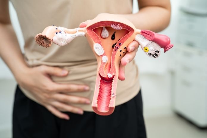 Ovulation Pain (Mittelschmerz) Ovulation Pain (Mittelschmerz)