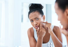 Period Acne: Why It Happens and How to Manage Hormonal Breakouts Period Acne Why It Happens and How to Manage Hormonal Breakouts