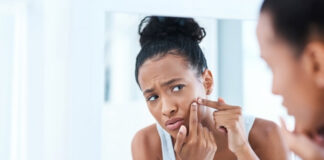 Period Acne: Why It Happens and How to Manage Hormonal Breakouts Period Acne Why It Happens and How to Manage Hormonal Breakouts