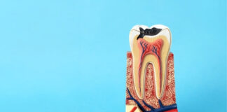 Plaque vs Tartar: What’s the Difference and How to Get Rid of Both Plaque vs Tartar What's the Difference