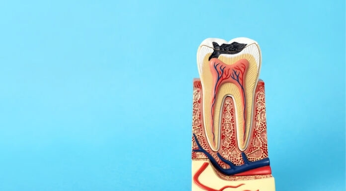 Plaque vs Tartar: What’s the Difference and How to Get Rid of Both Plaque vs Tartar What's the Difference
