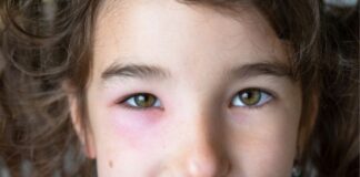 Signs of Prader-Willi Syndrome: What to Look for at Every Age Signs of Prader-Willi Syndrome