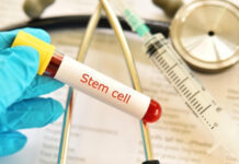 Stem Cell Therapy for Type 1 Diabetes: How Close Are We to a Real Cure? Stem Cell Therapy for Type 1 Diabetes How Close Are We to a Real Cure