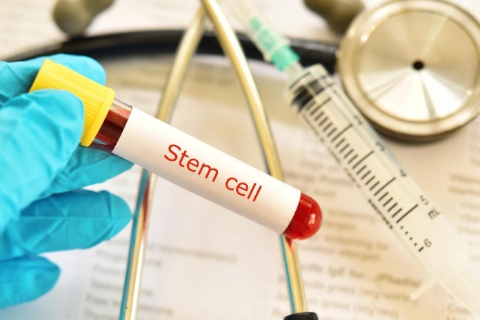 Stem Cell Therapy for Type 1 Diabetes How Close Are We to a Real Cure Stem Cell Therapy for Type 1 Diabetes How Close Are We to a Real Cure