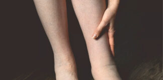 Swollen Legs and Ankles: When It’s a Heart Failure Warning Sign — and When It Isn’t’ Swollen Legs and Ankles