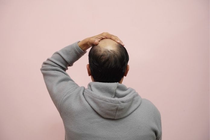 What This Means for Men_ The Androgenetic Alopecia Consideration