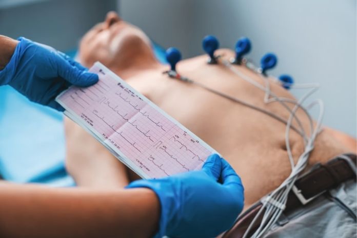 Why Heart Rhythm Monitoring Is Sometimes Needed