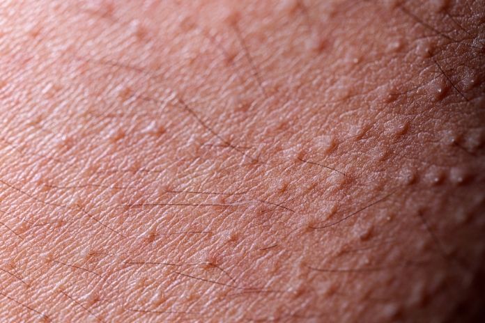 Why Your Skin Feels Like Sandpaper