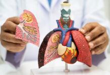 7 Skin Symptoms That Could Signal Lung Cancer — and When to See a Doctor 7 Skin Symptoms That Could Signal Lung Cancer and When to See a Doctor