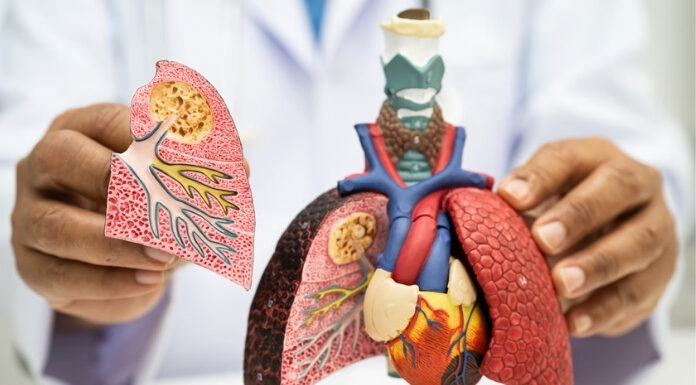 7 Skin Symptoms That Could Signal Lung Cancer — and When to See a Doctor 7 Skin Symptoms That Could Signal Lung Cancer and When to See a Doctor
