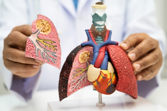 7 Skin Symptoms That Could Signal Lung Cancer and When to See a Doctor 7 Skin Symptoms That Could Signal Lung Cancer and When to See a Doctor