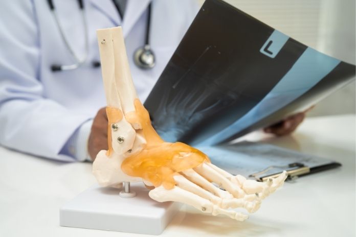 Bone Density_ One of the Most Important Changes
