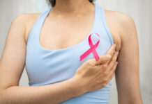 Breast Cancer Stages Explained: From Stage 0 to Stage 4 Breast Cancer Stages Explained From Stage 0 to Stage 4