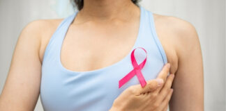 Breast Cancer Stages Explained: From Stage 0 to Stage 4 Breast Cancer Stages Explained From Stage 0 to Stage 4