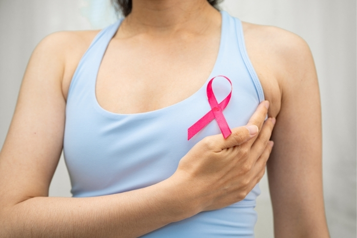 Breast Cancer Stages Explained From Stage 0 to Stage 4 Breast Cancer Stages Explained From Stage 0 to Stage 4
