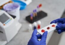 Can a Routine Blood Test Detect Cancer Early? What the Science Now Shows Can a Routine Blood Test Detect Cancer Early