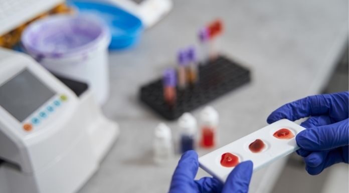 Can a Routine Blood Test Detect Cancer Early? What the Science Now Shows Can a Routine Blood Test Detect Cancer Early