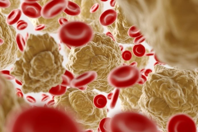 Cholesterol Reduction_ Unique Compound You Don’t Get Elsewhere