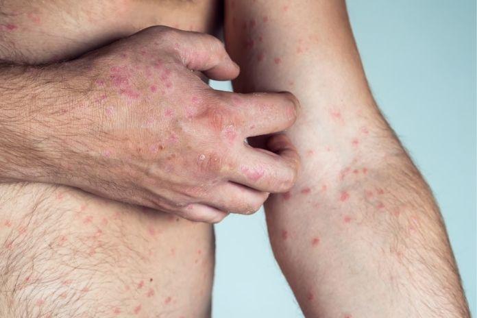 Common Causes - From Skin Conditions to Systemic Disease