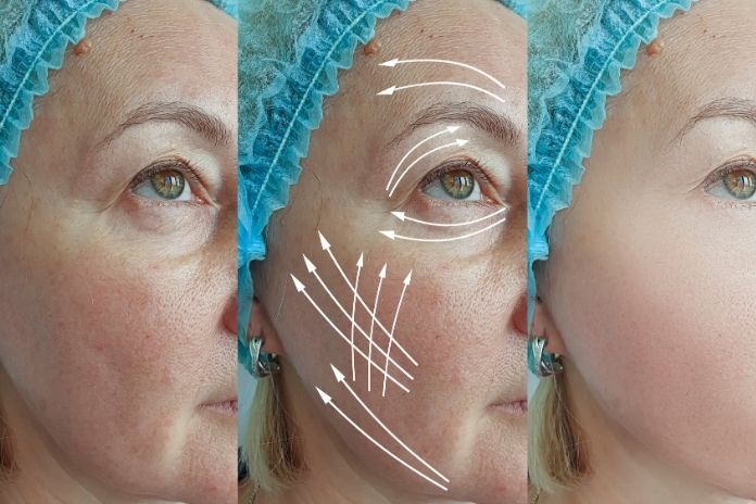 Common Menopause Skin Changes