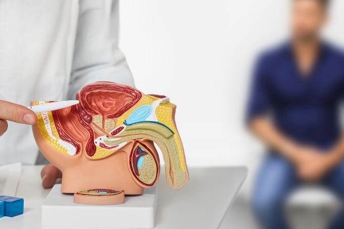 Common Myths About Prostate Cancer