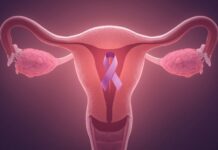 Endometrial Cancer vs PCOS: Overlapping Signs and How to Tell Them Apart Endometrial Cancer vs PCOS