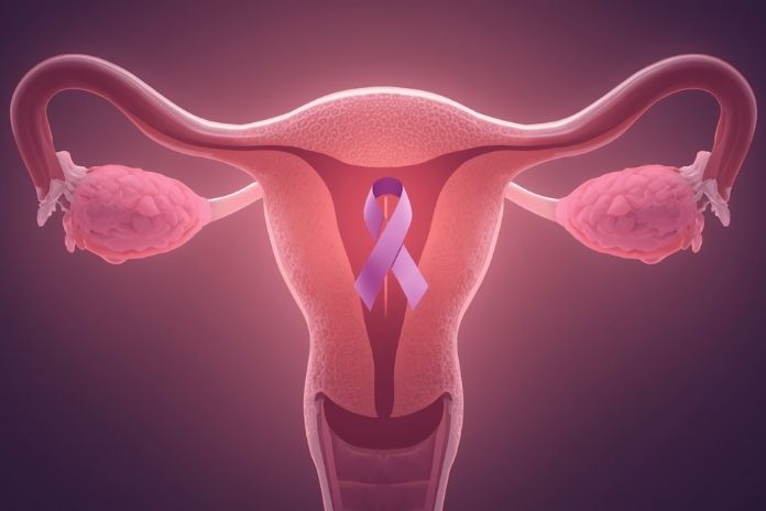 Endometrial Cancer vs PCOS Endometrial Cancer vs PCOS