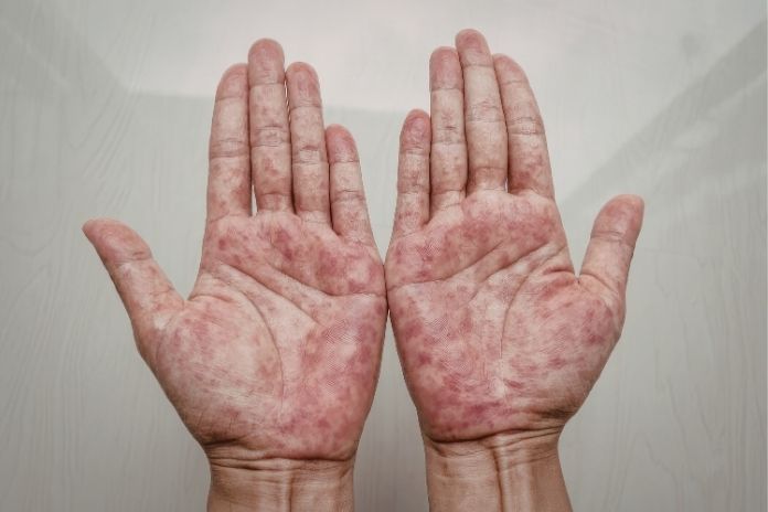 From Coal Tar to Biologics From Coal Tar to Biologics