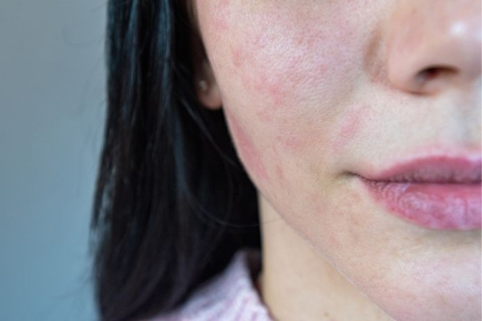 Head-to-Head by Skin Concern