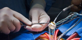 Heart Valve Replacement: Traditional Surgery vs. TAVR Heart Valve Replacement Traditional Surgery vs TAVR