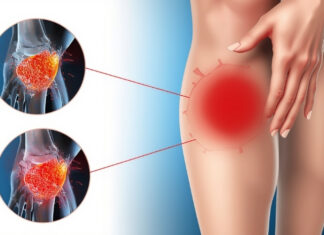 How Long Does Inflammation Last After an Injury? How Long Does Inflammation Last After an Injury