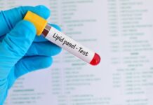 How to Interpret Your Lipid Panel Results: A Simple Guide to Cholesterol Numbers How to Interpret Your Lipid Panel Results