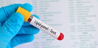 How to Interpret Your Lipid Panel Results: A Simple Guide to Cholesterol Numbers How to Interpret Your Lipid Panel Results