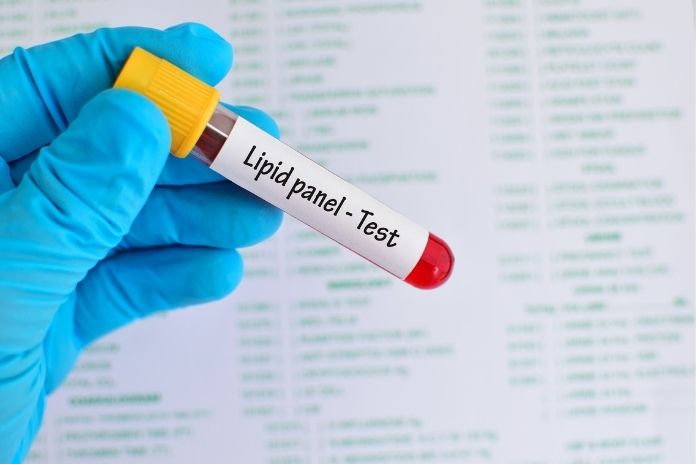 How to Interpret Your Lipid Panel Results How to Interpret Your Lipid Panel Results