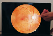 How to Prevent Macular Degeneration: What the Evidence Actually Supports How to Prevent Macular Degeneration