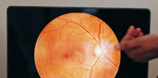 How to Prevent Macular Degeneration: What the Evidence Actually Supports How to Prevent Macular Degeneration