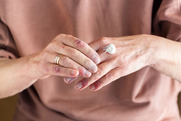 How to Treat a Hay Fever Rash