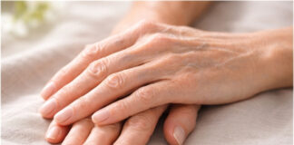Is “Ozempic Hand” Aging Permanent? Timeline for Skin Tightening After Weight Loss Is Ozempic Hand Aging Permanent