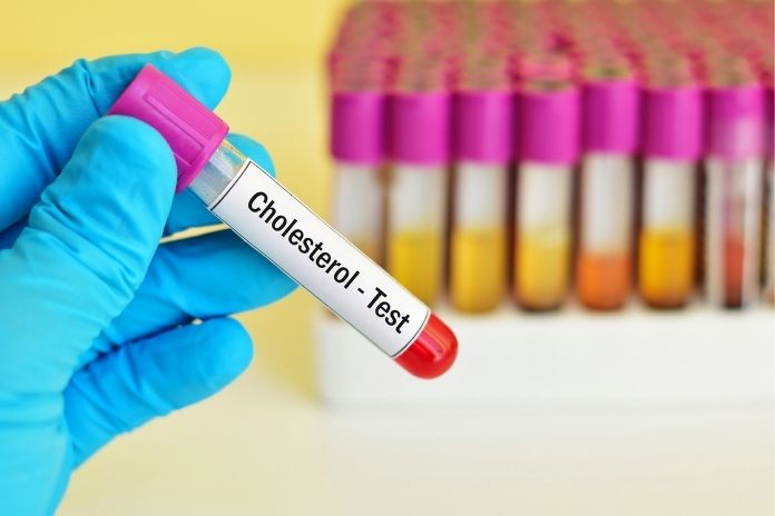 Key Blood Tests That Go Beyond Cholesterol