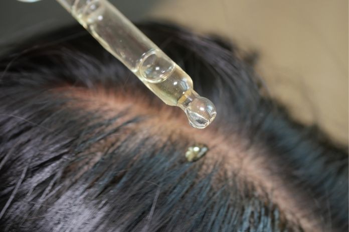 Practical Tips for Using Minoxidil Effectively