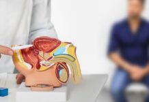 Recurring Prostate Cancer: Can Treatment Be Safely Delayed? Recurring Prostate Cancer