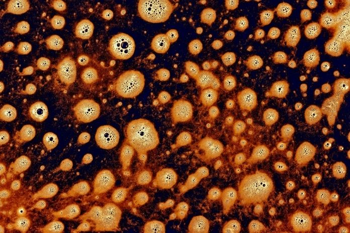 Strategy 4 Constant Change Tumor Heterogeneity and Immune Escape