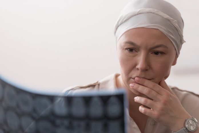 The Cancers Most Likely to Remain Asymptomatic Until Advanced