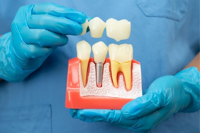 Tooth Preparation Enamel Removal
