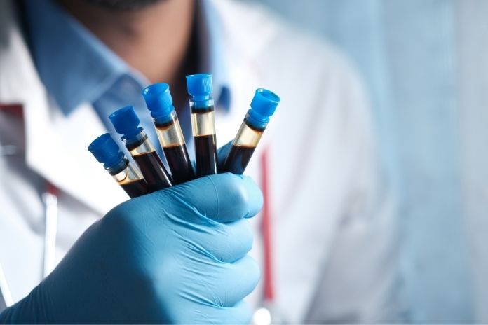 Understanding PSA Tests and Screening Results