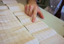Understanding Your Echocardiogram Results: What the Numbers Mean Understanding Your Echocardiogram Results