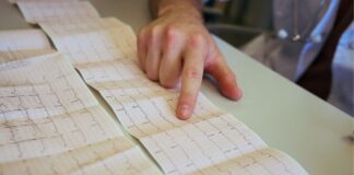Understanding Your Echocardiogram Results: What the Numbers Mean Understanding Your Echocardiogram Results
