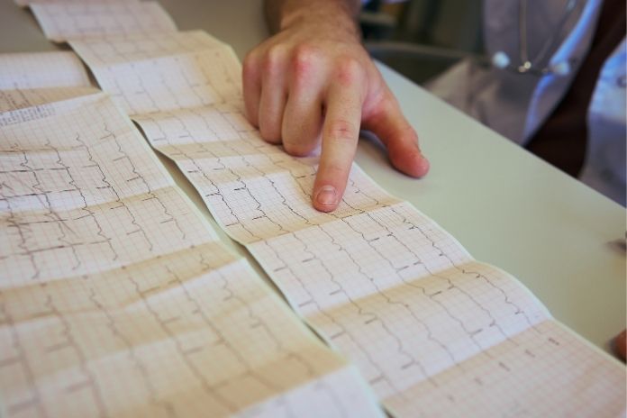 Understanding Your Echocardiogram Results Understanding Your Echocardiogram Results
